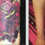 A multi coloured tattoo before and after
